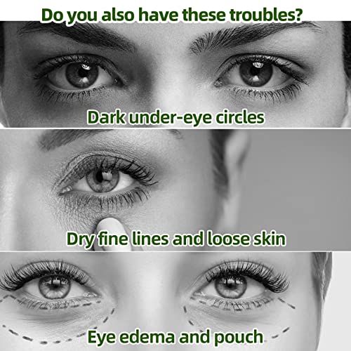 HHSEYEWELL נקי ומושלם לטיפול בעיניים מיצוק והרמת שקיות עיניים דועכות קווי עיניים מעגלים כהים מפחיתים טיפוח עיניים קמטים שקית עיניים איפור